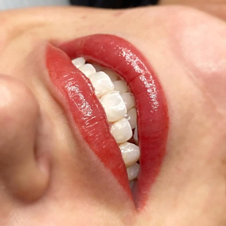 Close-up of lips with an even glossy red tint and defined edges, with upper teeth visible, photographed at an angle.
