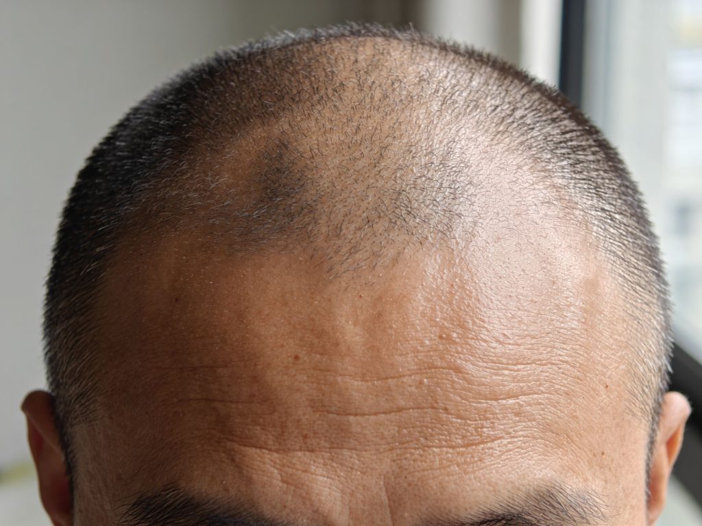 Building a shaved head look with SMP: what really happens across sessions